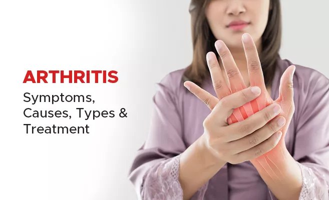 artheritis