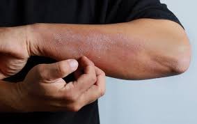 skin